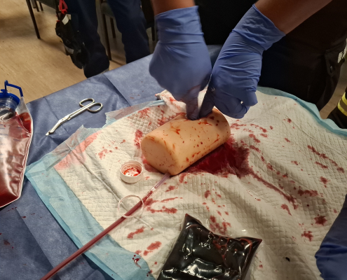 Wundtamponade (Wound Packing) bei einer tiefen Verletzung. Die Wunde wird mit steriler Gaze fest ausgefüllt, um die Blutung von innen zu kontrollieren. Anschließend erfolgt die Sicherung mit einem Druckverband zur weiteren Stabilisierung bis zum Eintreffen des Rettungsdienstes.