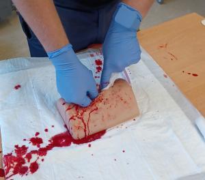 Die Wunde wird mit steriler Gaze fest ausgefüllt, um die Blutung von innen zu kontrollieren. Anschließend erfolgt die Sicherung mit einem Druckverband zur weiteren Stabilisierung bis zum Eintreffen des Rettungsdienstes.